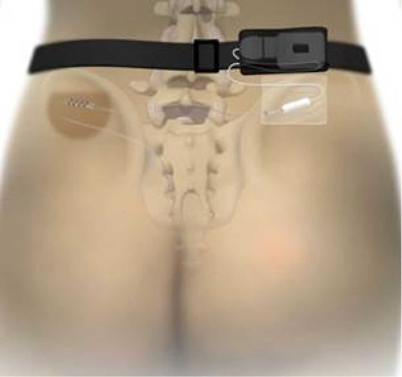 verify-eerste-fase-met-riempje.jpg verify-eerste-fase-met-riempje.jpg