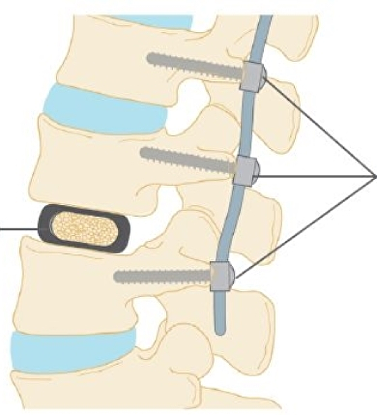 Afbeeldingsresultaat