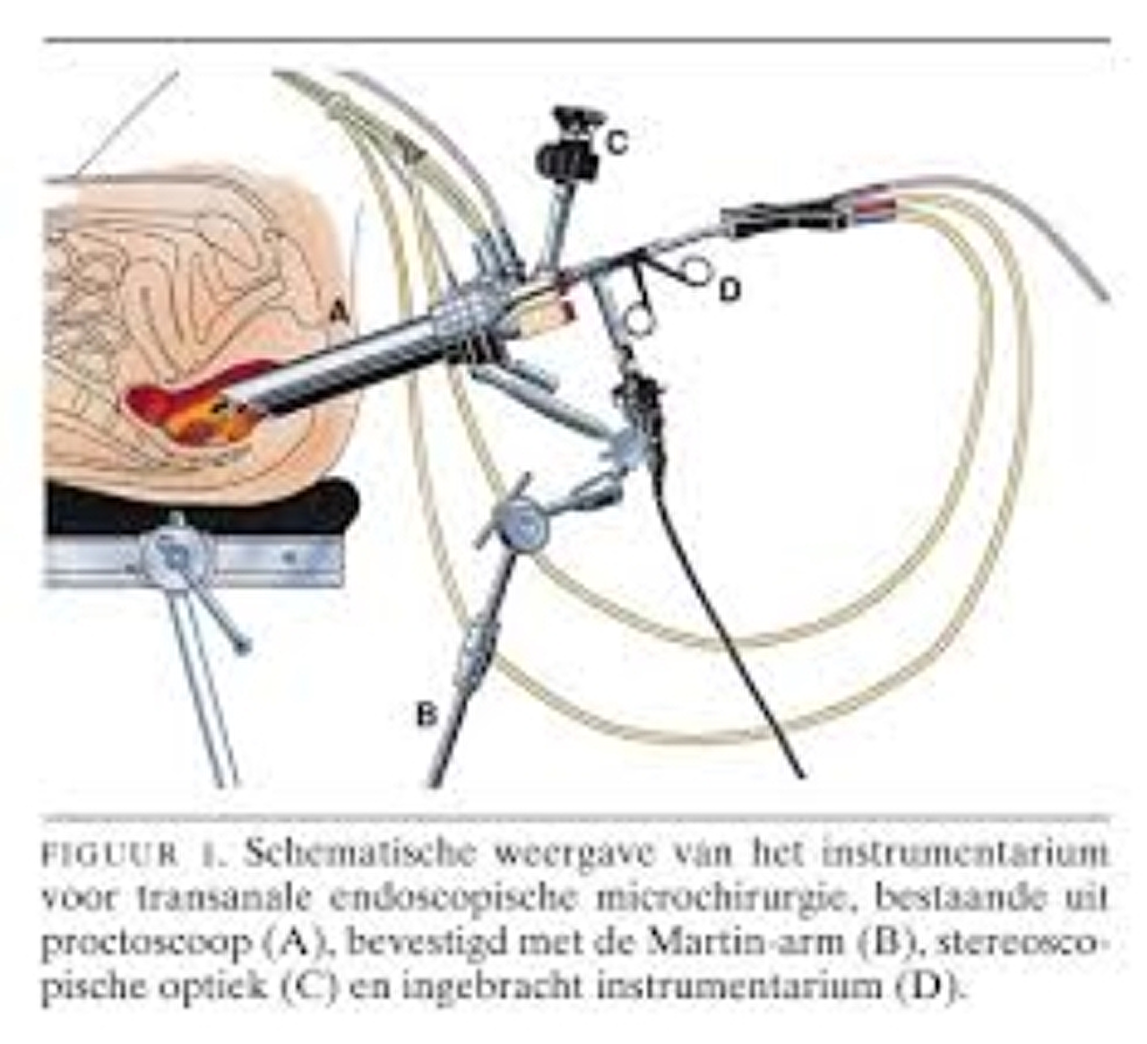 C:\Users\MVERMEULEN\AppData\Local\Microsoft\Windows\INetCache\Content.MSO\9C26A5C3.tmp