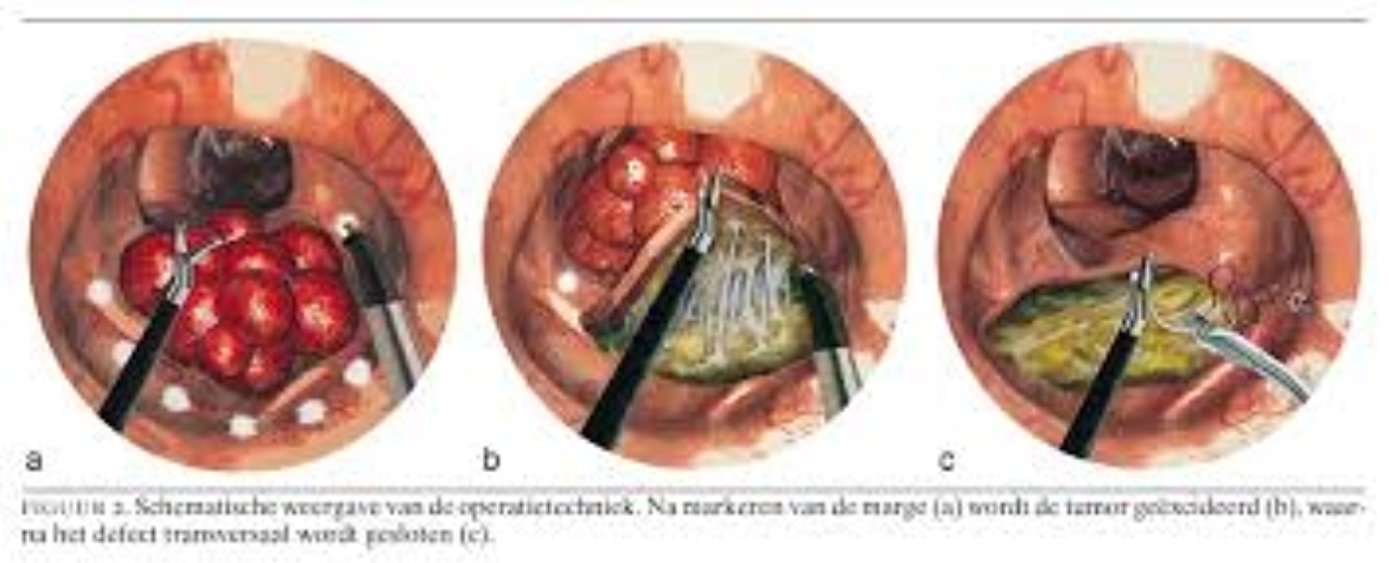 C:\Users\mvermeulen\AppData\Local\Microsoft\Windows\INetCache\Content.MSO\D30BC372.tmp