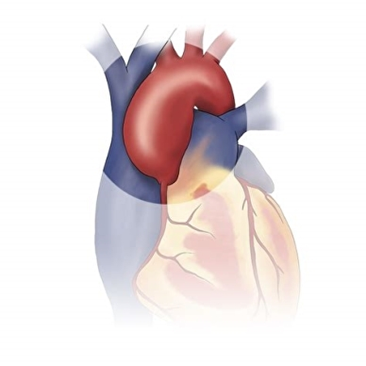 Afbeeldingsresultaten