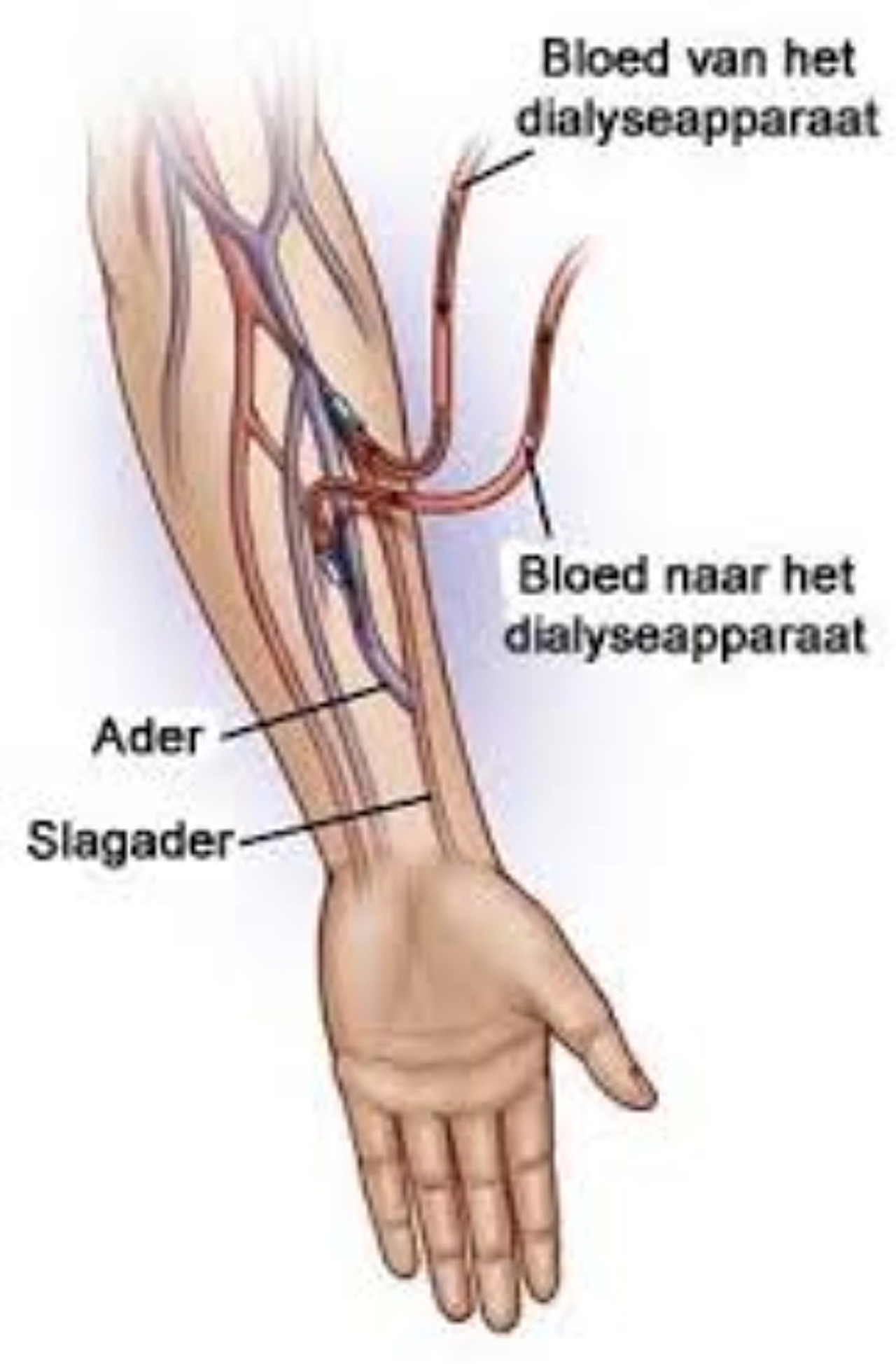 Afbeeldingsresultaat Afbeeldingsresultaat