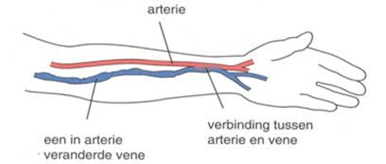 Av