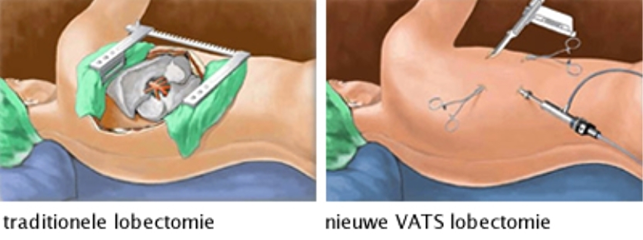 traditionele traditionele