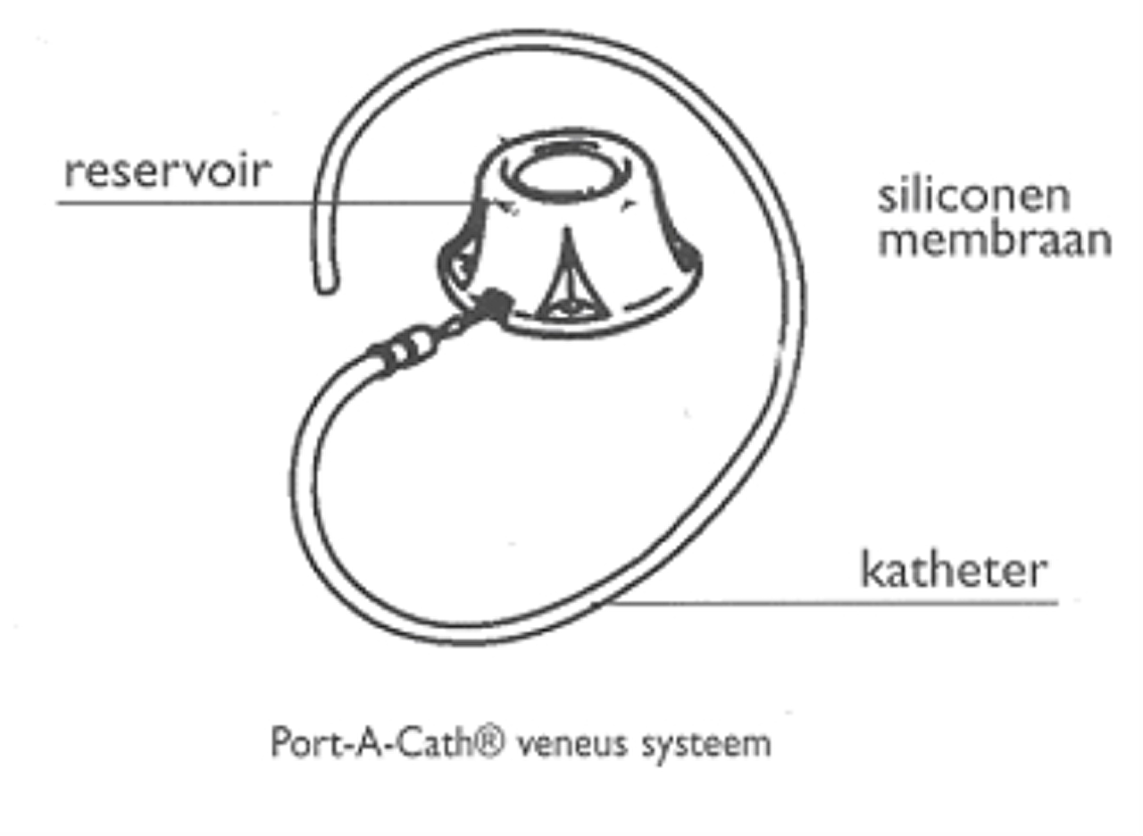 https://www.bravisziekenhuis.nl/files/original/537/1239-werking-pac.png https://www.bravisziekenhuis.nl/files/original/537/1239-werking-pac.png
